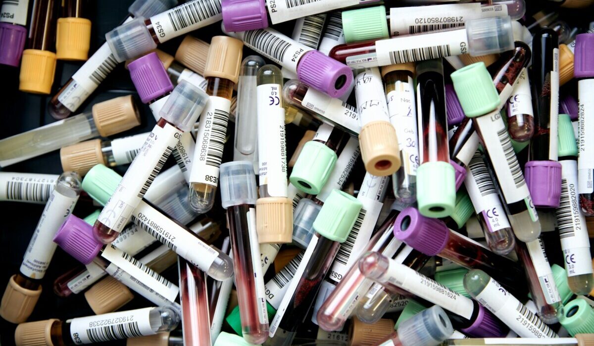 Blood gas analysis samples