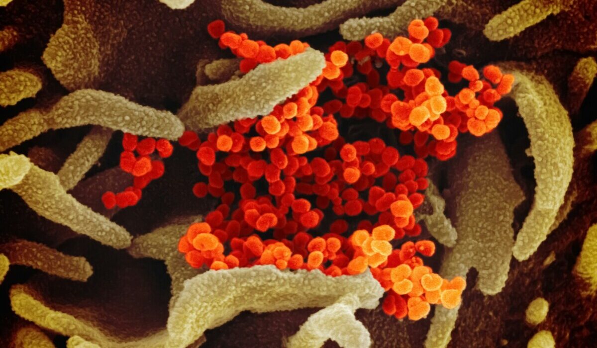 Immunology testing department